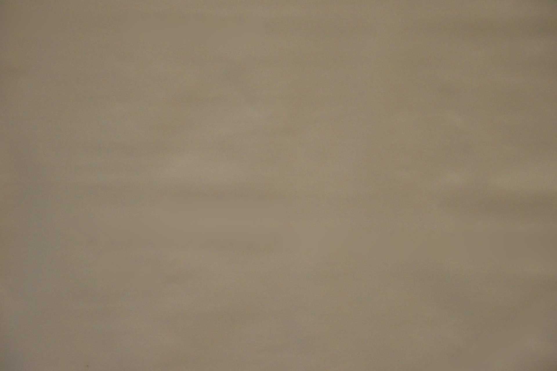 Image To Zoom